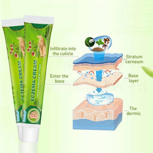 Sumifun Eczema Herbal Antibacterial Cream - 20g - Glow Getter Beauty