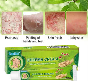 Sumifun Eczema Herbal Antibacterial Cream - 20g - Glow Getter Beauty