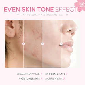 Laikou Japan Sakura Skin Care 5Pcs Set - Glow Getter Beauty