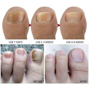 Vibrant Glamour Nail Repair Cream Anti Fungal Nails Repair Nourishing- 20g - Glow Getter Beauty