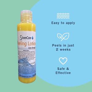 Skeen Care Extra Strength Peeling Lotion Skeencare - Glow Getter Beauty