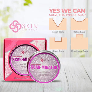 Skin Sensation Scar-minator Cream - 50ml - Glow Getter Beauty