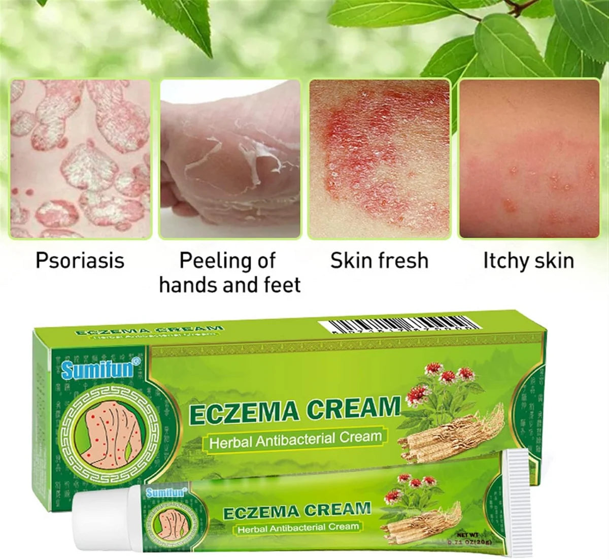 Sumifun Eczema Herbal Antibacterial Cream - 20g - Glow Getter Beauty