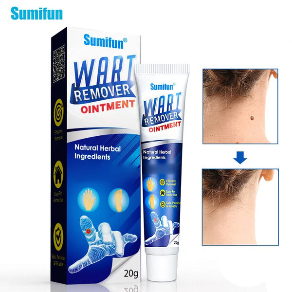 Sumifun Wart Remover Ointment - 20g - Glow Getter Beauty