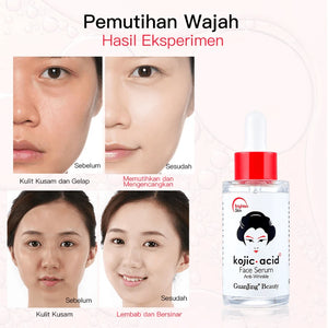 Guanjing Beauty Kojic Acid Anti-Wrinkle Face Serum - 40ml - Glow Getter Beauty