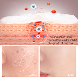 Vibrant Glamour Salicylic Acid Acne Soap - 100g - Glow Getter Beauty