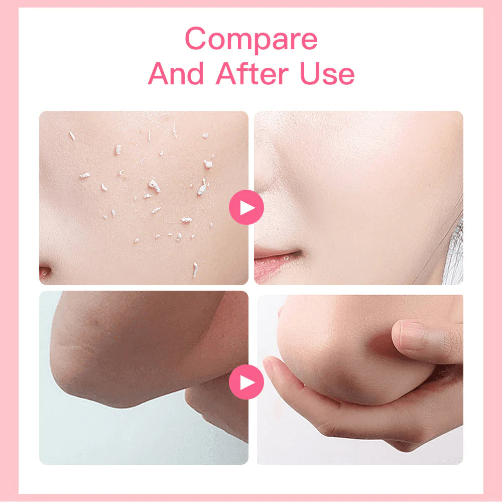 Aichun Beauty Strawberry Whitening Skin Peeling Gel Face & Body - 100g - Glow Getter Beauty