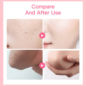 Aichun Beauty Strawberry Whitening Skin Peeling Gel Face & Body - 100g - Glow Getter Beauty