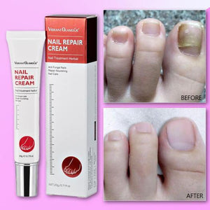 Vibrant Glamour Nail Repair Cream Anti Fungal Nails Repair Nourishing- 20g - Glow Getter Beauty