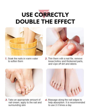 Vibrant Glamour Nail Repair Cream Anti Fungal Nails Repair Nourishing- 20g - Glow Getter Beauty