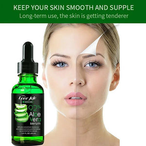 Love JoJo Skin Care Aloe Vera Serum (Black) - 30ml - Glow Getter Beauty