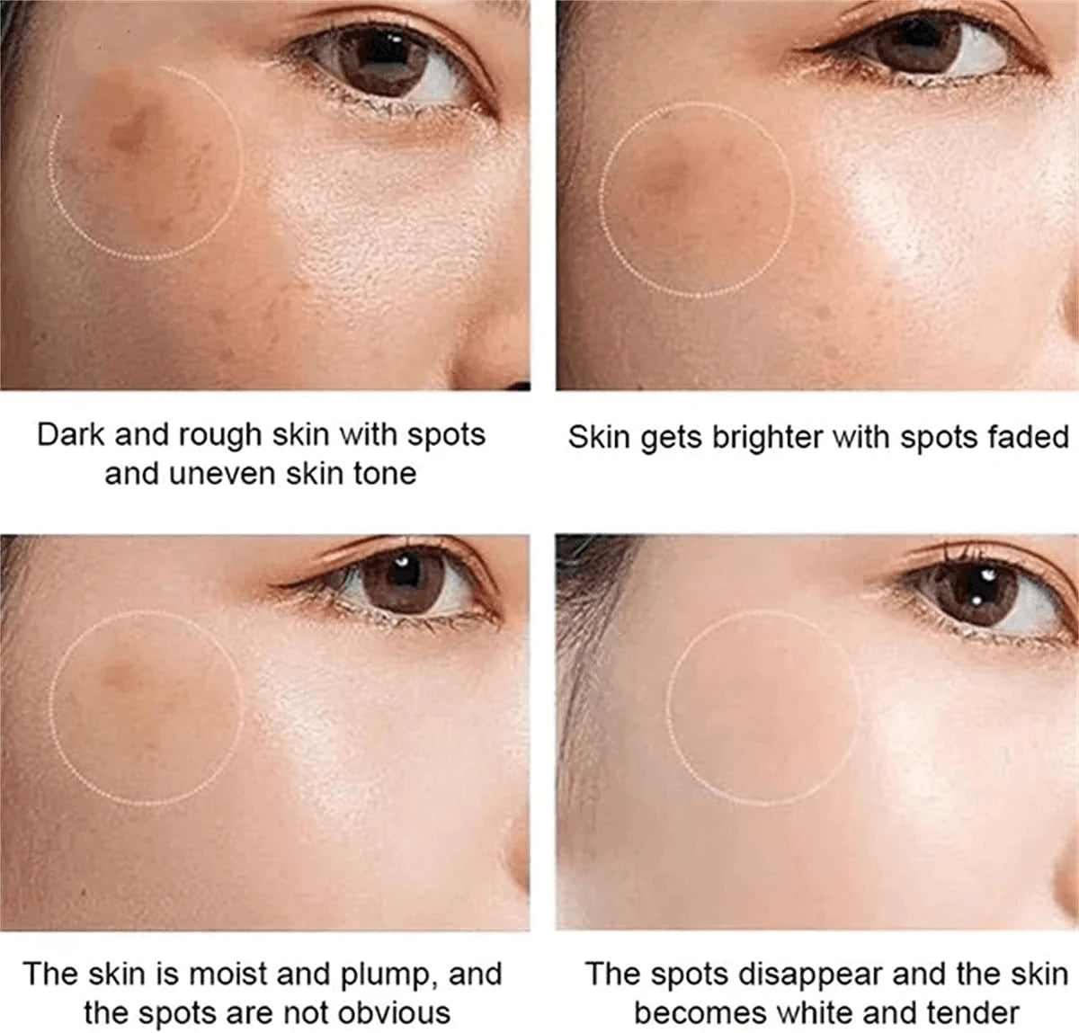 Dr Hancy White Spot Cream Japan Cream - 20g - Glow Getter Beauty
