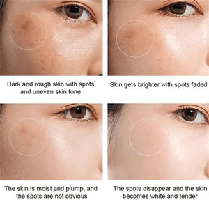 Dr Hancy White Spot Cream Japan Cream - 20g - Glow Getter Beauty