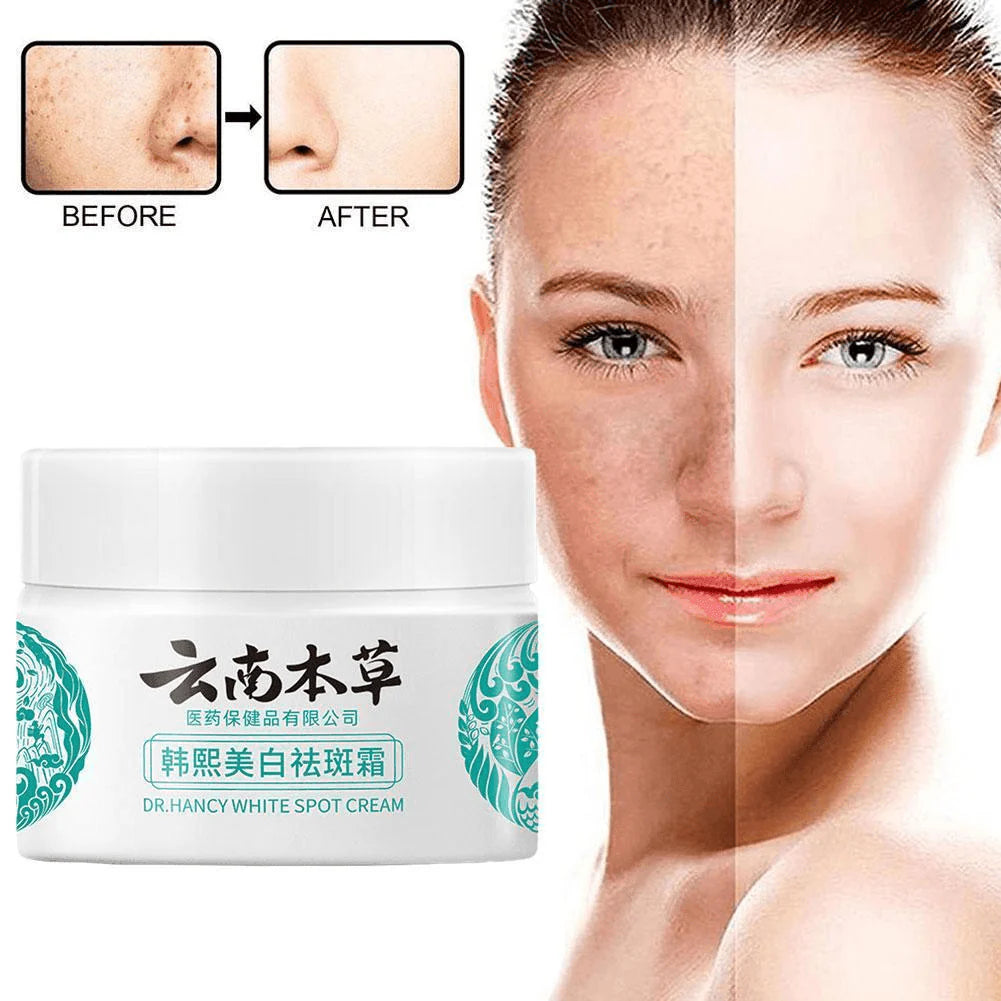 Dr Hancy White Spot Cream Japan Cream - 20g - Glow Getter Beauty